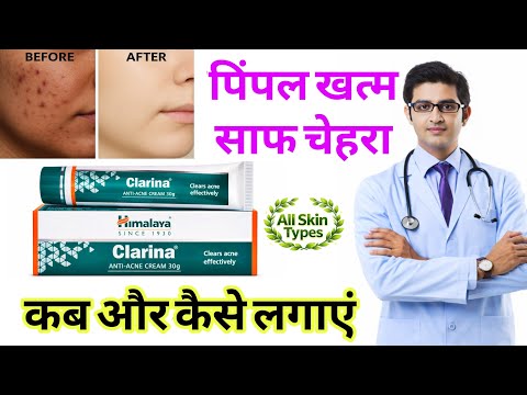 himalaya clarina cream ke fayde in hindi