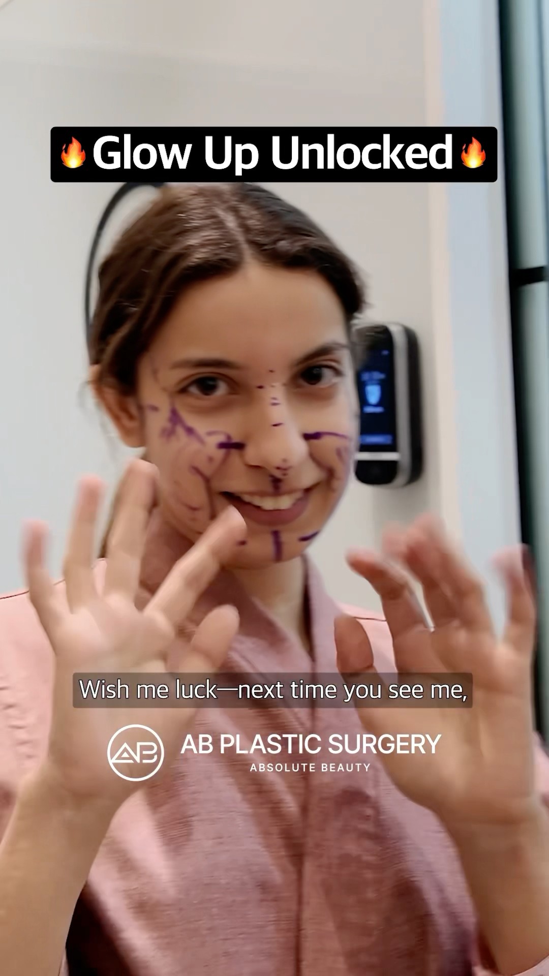 4 Months After Korean Plastic Surgery | See the Healing & Results