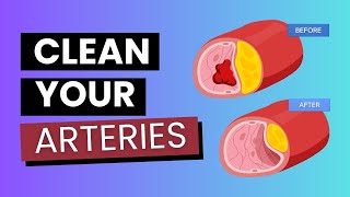 8 Best Vitamins That May Help Slow Plaque Buildup in Your Arteries