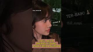 Download lagu Permesta udah ga pesek lagi setelah operasi di dr.Tompi mp3