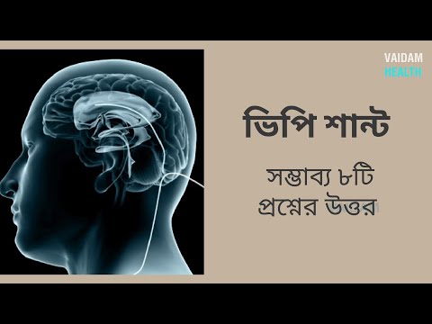 ভিপি শান্ট - প্রায়শই জিজ্ঞাসিত প্রশ্ন