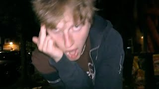 Lip Filler – “Its Not Deep”