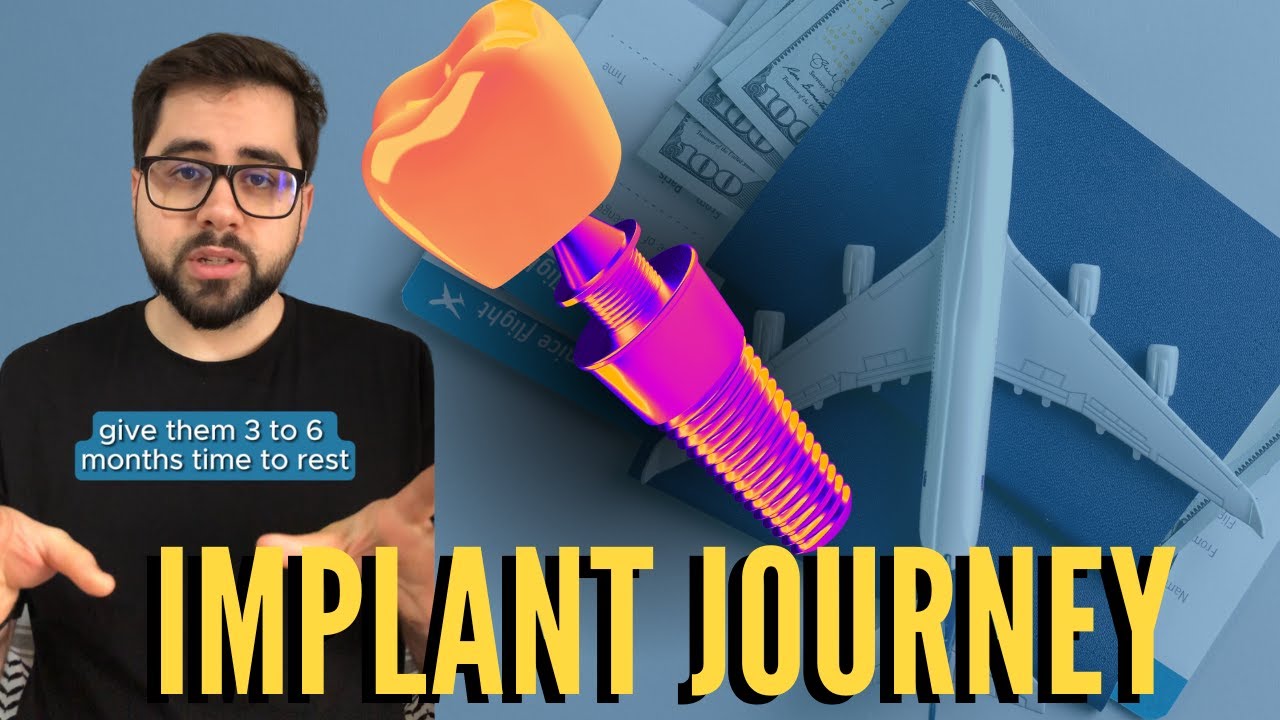 Implant Journey
