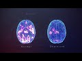 How Does TMS Therapy Work TMS