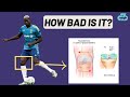 Expert Explains Paul Pogba Injury (meniscus tear) & Timeline Scenarios