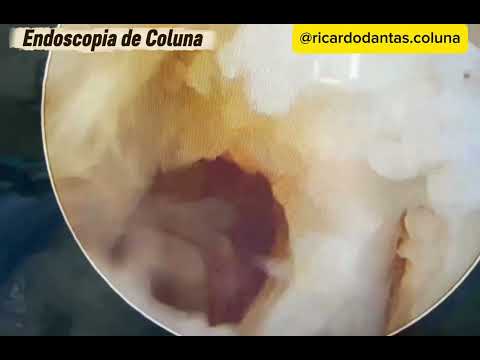 Ricardo Dantas-24