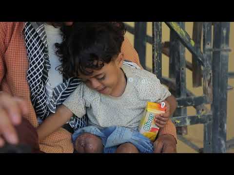 بالفيديو: كيف غيرت الألغام حياة الطفل اليمني أمير