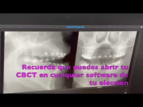 CBCT-TOMOGRAFIA en Maxilar  QUETZALTENANGO Y SANTA CRUZ DEL QUICHE 2026