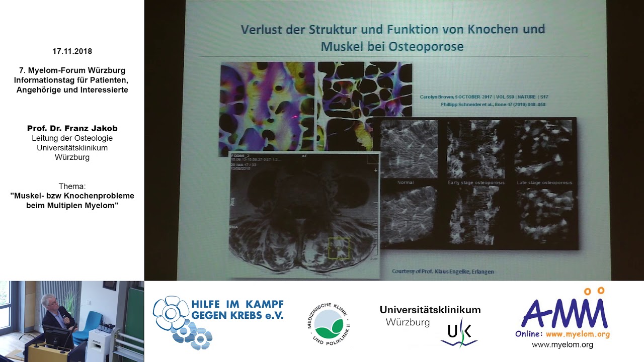Wie bedroht das Myelom die Niere und was kann man dagegen tun?