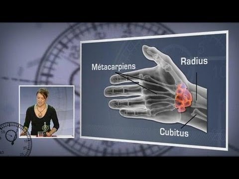 comment guerir tendinite poignet