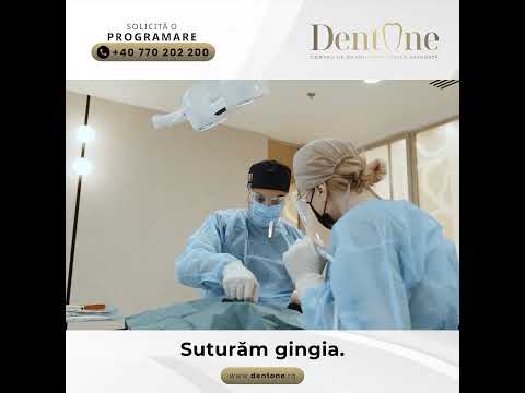 Transformare dentară spectaculoasă: Dinți provizorii în doar câteva ore!