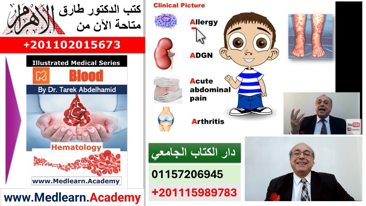 Henoch- Schonlein purpura (HSP)   #cme #internal_medicine #medical #usmle #محاضرات_باطنة #USMLE