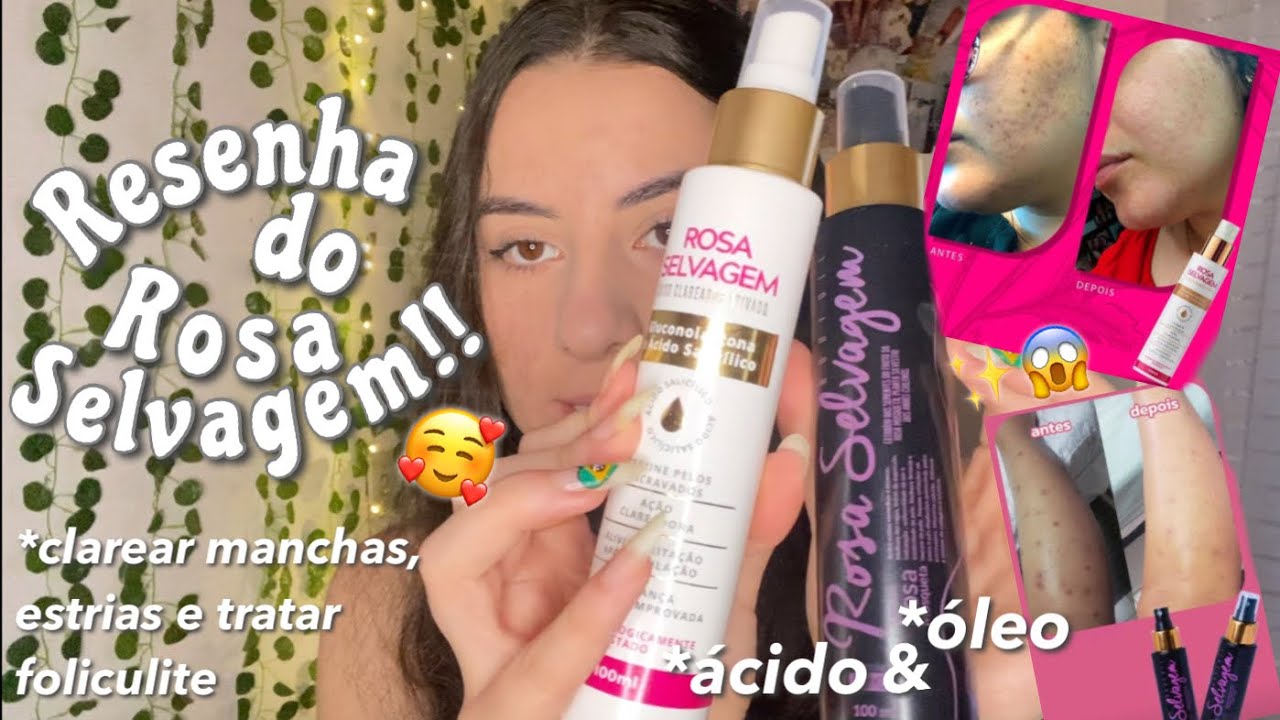 RESENHA ROSA SELVAGEM ÓLEO E ÁCIDO!!✨ *clarear manchas, estrias e tratar foliculite