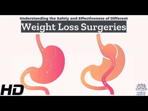 Effects of Cannabis on your body