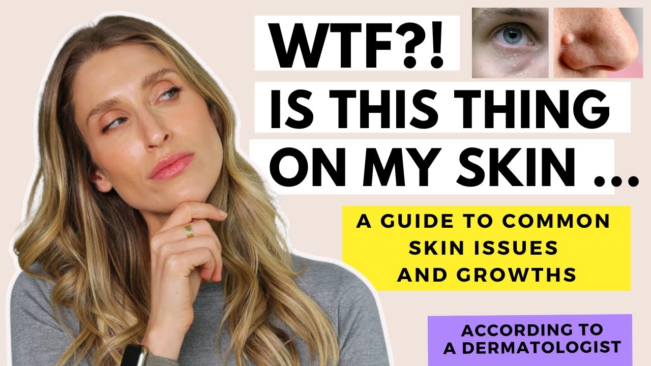 A Dermatologist's Guide to Skin Growths | Dr. Sam Ellis