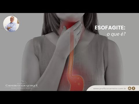 Esofagite: o que é, causas e tratamento | Prof. Dr. Luiz Carneiro CRM 22.761