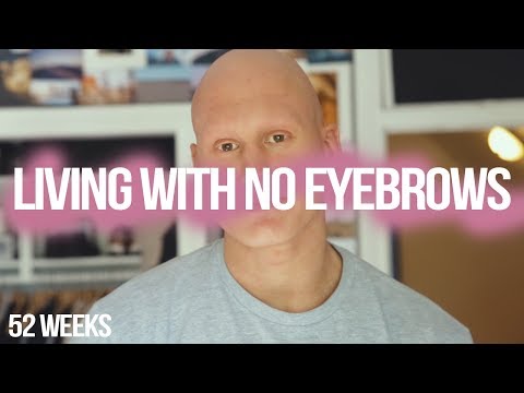 What It's Like Living With No Eyebrows (Alopecia Universalis)