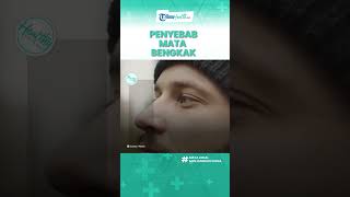 Alami Mata Bengkak Tanpa Sadar yang Kerap Ditakutkan, Inilah Penyebab dan Cara Mengobatinya