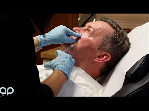 Demonstration: Before and After Botox and Dermal Fillers for Men