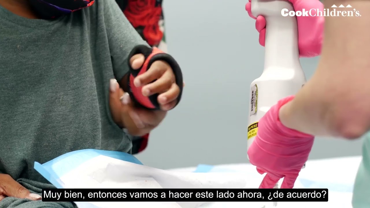 Cómo se retira un yeso