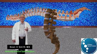 What Is Minimally Invasive Lumbar Surgery?