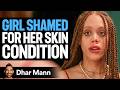 She Was Judged For Her Looks Now She S A Role Model Dhar Mann Studios