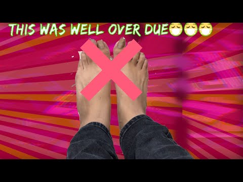 THE UGLIEST FEET TRANSFORMATION EVER DONE🤢🤮