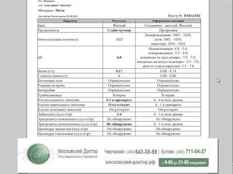 08 боль в спине Боль слева от солнечного сплетения в спине