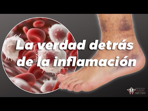 ¿Cómo funciona la inflamación? | Instituto de Anatomía Humana