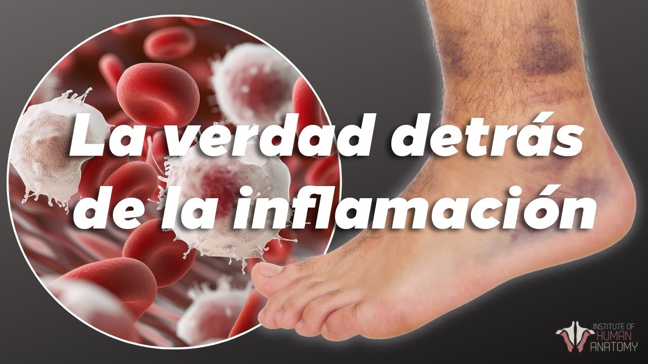 ¿Cómo funciona la inflamación? | Instituto de Anatomía Humana