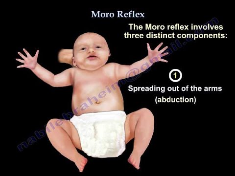 Moro Reflex