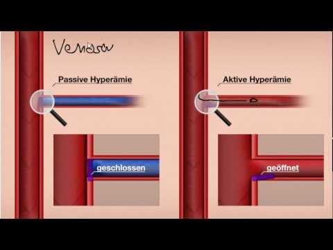 Aktive und Passive Hyperämie (Manuelle Lymphdrainage)