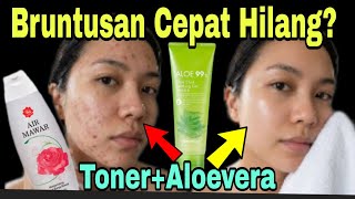 Download lagu Blemishes disappear quickly and will never come back again. mp3 Download lagu Blemishes disappear quickly and will never come back again. mp3