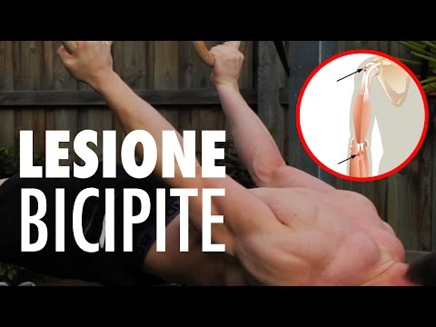 Urto mal di testa sul collo Scoliosi toracica di 2 gradi prendere sia nellesercito