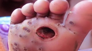 Patrick - Extended Cut w FAQs - Deep Jigger Digging