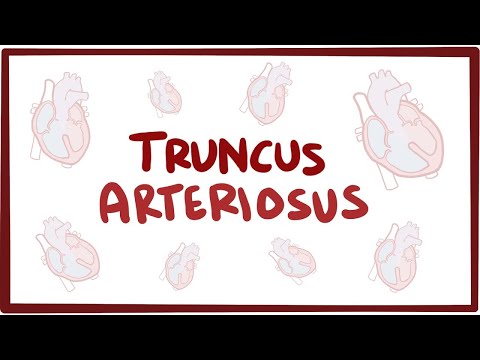 Rheumatic fever heart disease an Osmosis Preview