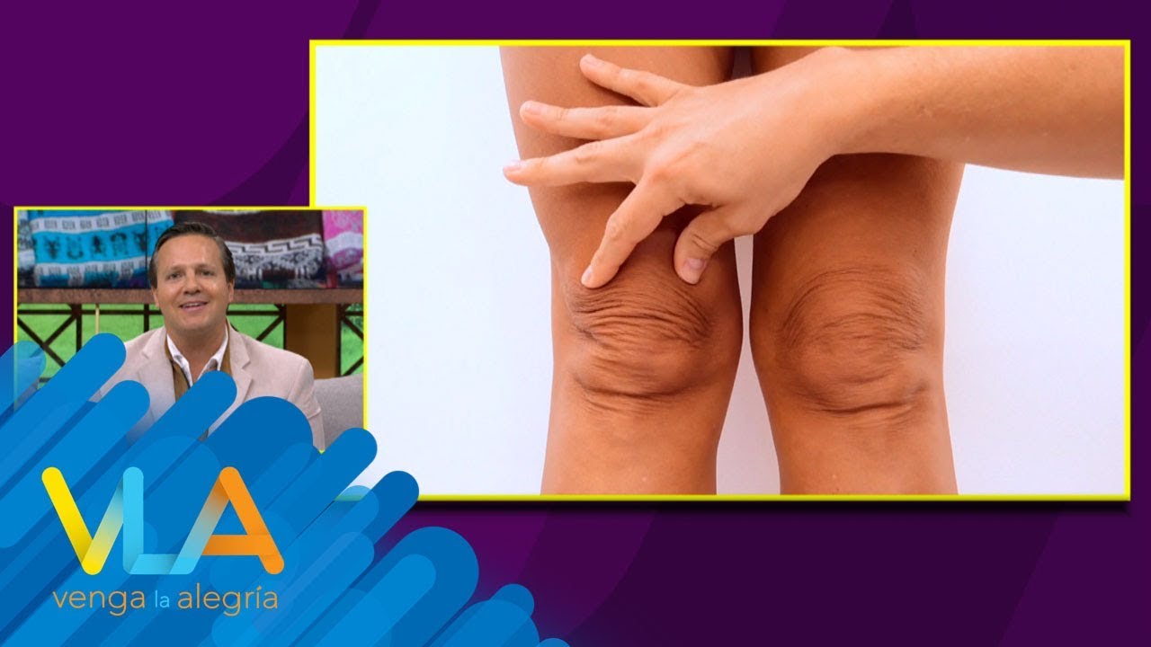 Watch ¿Cómo rejuvenecer las rodillas | Venga la Alegría Now ¿Cómo rejuvenecer las rodillas | Venga la Alegría