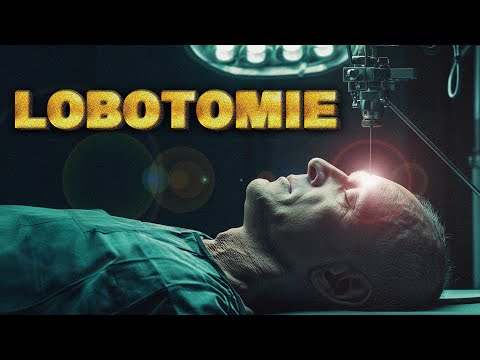 L'incroyable Histoire de la LOBOTOMIE