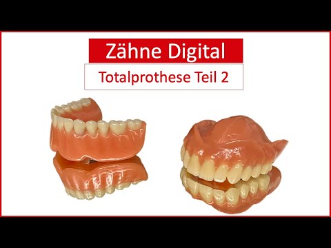 Zähne Digital - Totalprothese Teil 2
