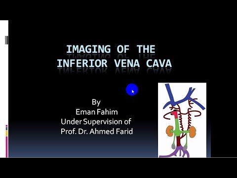 Imaging of IVC by DR EMAN FAHEEM