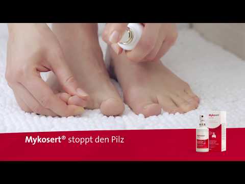 Fußpilz einfach behandeln - mit Mykosert® Spray bei Haut und Fußpilz