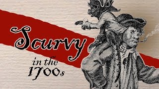 Scurvy In The 1700s – Q&A