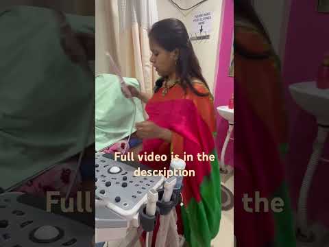 Copper T insertion | copper T side effects  | best gynaecologist | copper t for family planning