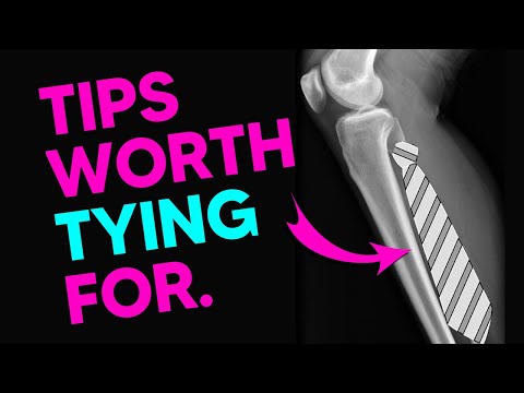 Lower Leg Muscle Mnemonics (Anterior & Lateral Compartments)