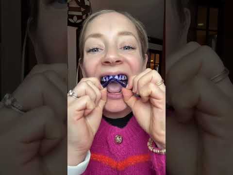 I thought all whitening strips were the same until I tried these