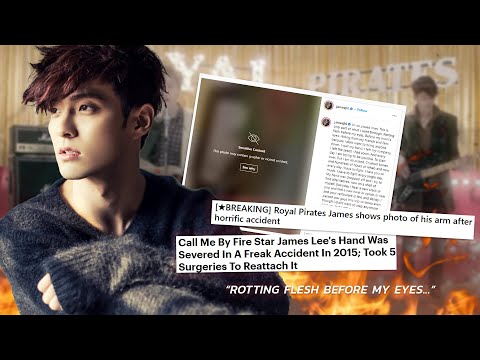 Career Ending Injuries? | | Tragic Accidents That Severely Injured Idols | | Midnight Theories 🔮