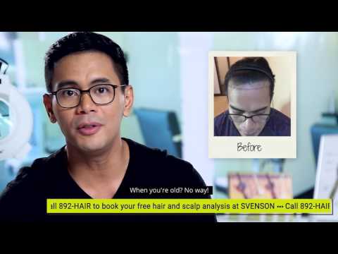 Hair Transplant at Svenson Philippines | Tonipet Gaba Testimonial