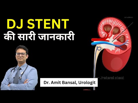 DJ Stent की पूरी जानकारी! ये क्या होती है? क्या फायदे होते हैं? इसके क्या side effects हो सकते हैं?