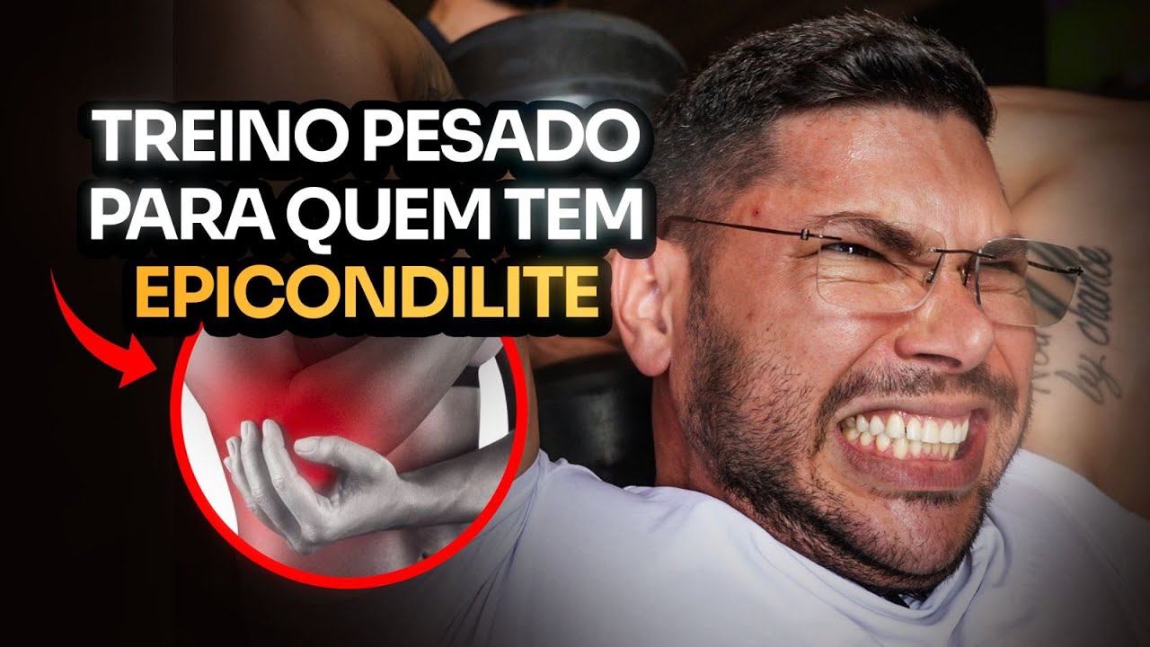TREINO DE BÍCEPS E TRÍCEPS PARA SEU ALUNO QUE TEM EPICONDILITE - LEANDRO RIBEIRO