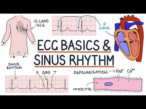 Understanding ECG Basics And Sinus Rhythm